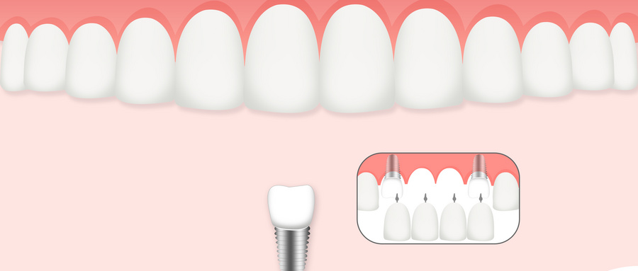 �����ǿƼ����WУ���V���׃���ǻ����o����